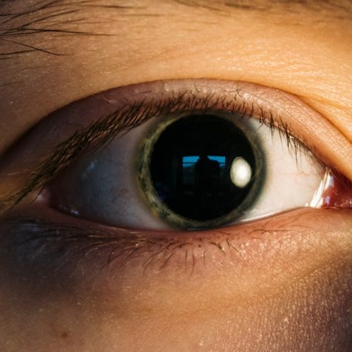 dilated